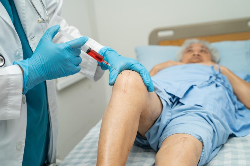 Synvisc Injection for Osteoarthritis
