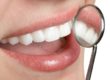 teeth-whitening-smile