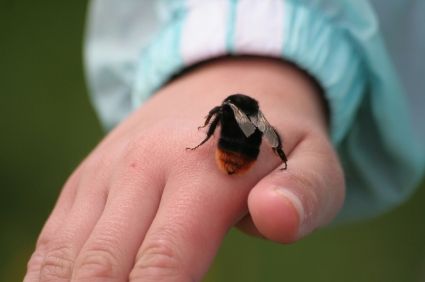 Bee sting