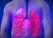 relation between pneumonial and calcium levels