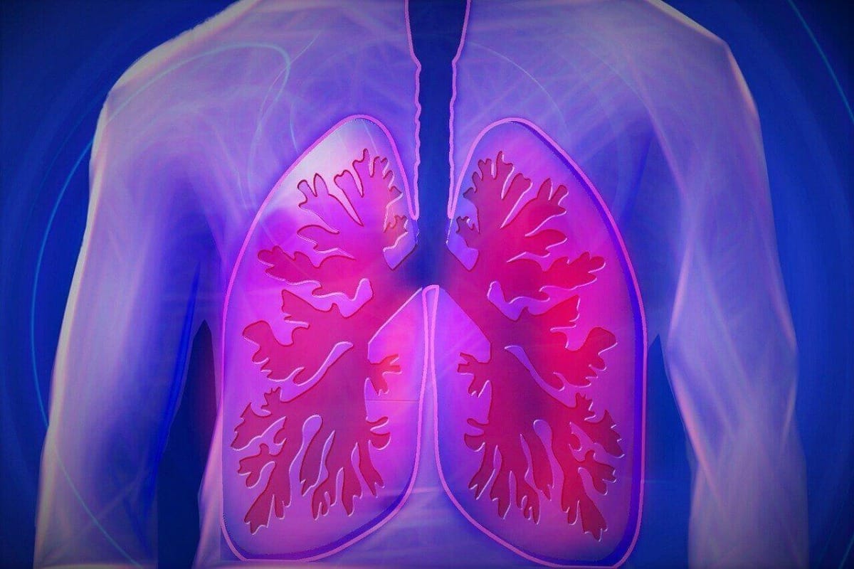 relation between pneumonial and calcium levels