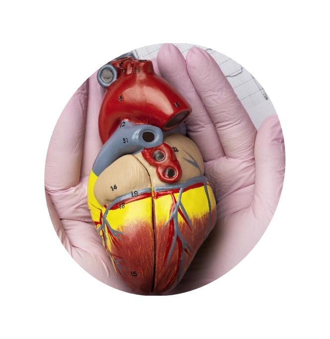 Doctor holding a clay model of a heart explaining High Cholesterol