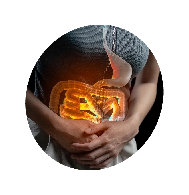 An illustration of an inflammatory bowel disease causing discomfort to a woman.




