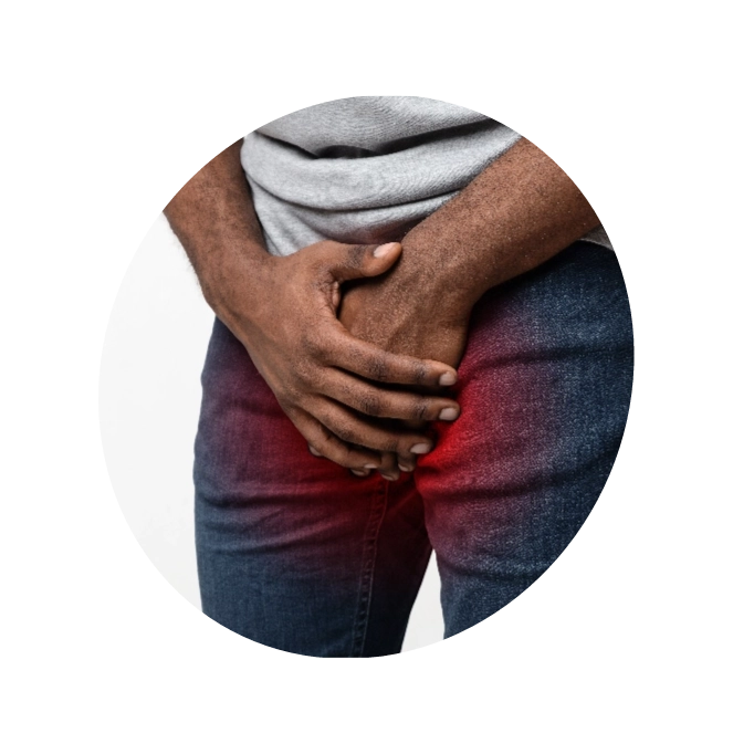 A man in pain, suffering from Cystitis, hand holding his crotch.