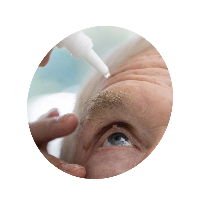 An old man administering his eyes with Glaucoma medication