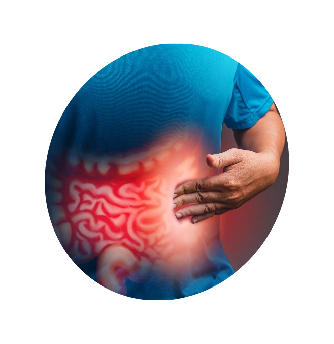 3D image of a man intestine suffering from symptoms of Gastroesophageal Reflux Disorder


An illustration of intestines explaining gastroesophageal reflux disorder"







