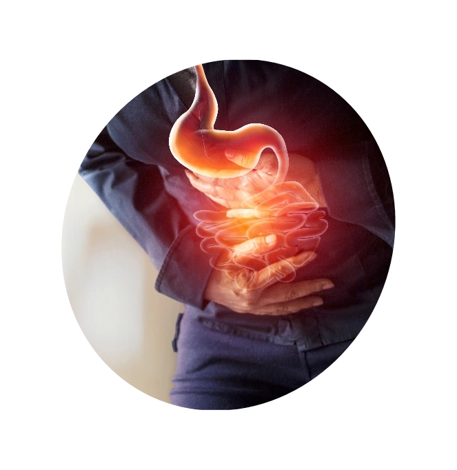 An illustration depicting a man clutching his abdomen in discomfort due to irritable bowel syndrome (IBS).
