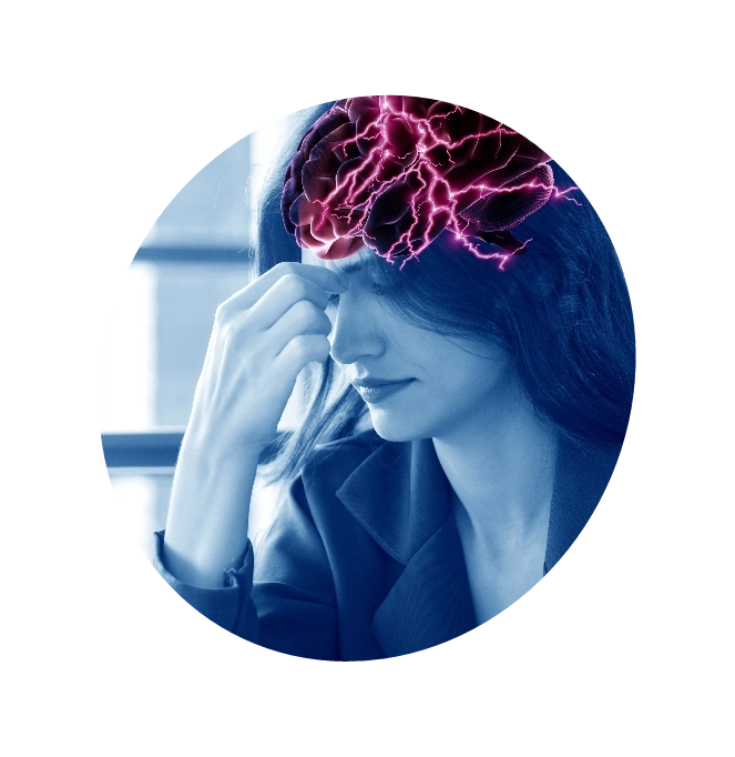 Illustration depicting the neural network within the brain of a woman experiencing neuralgia.